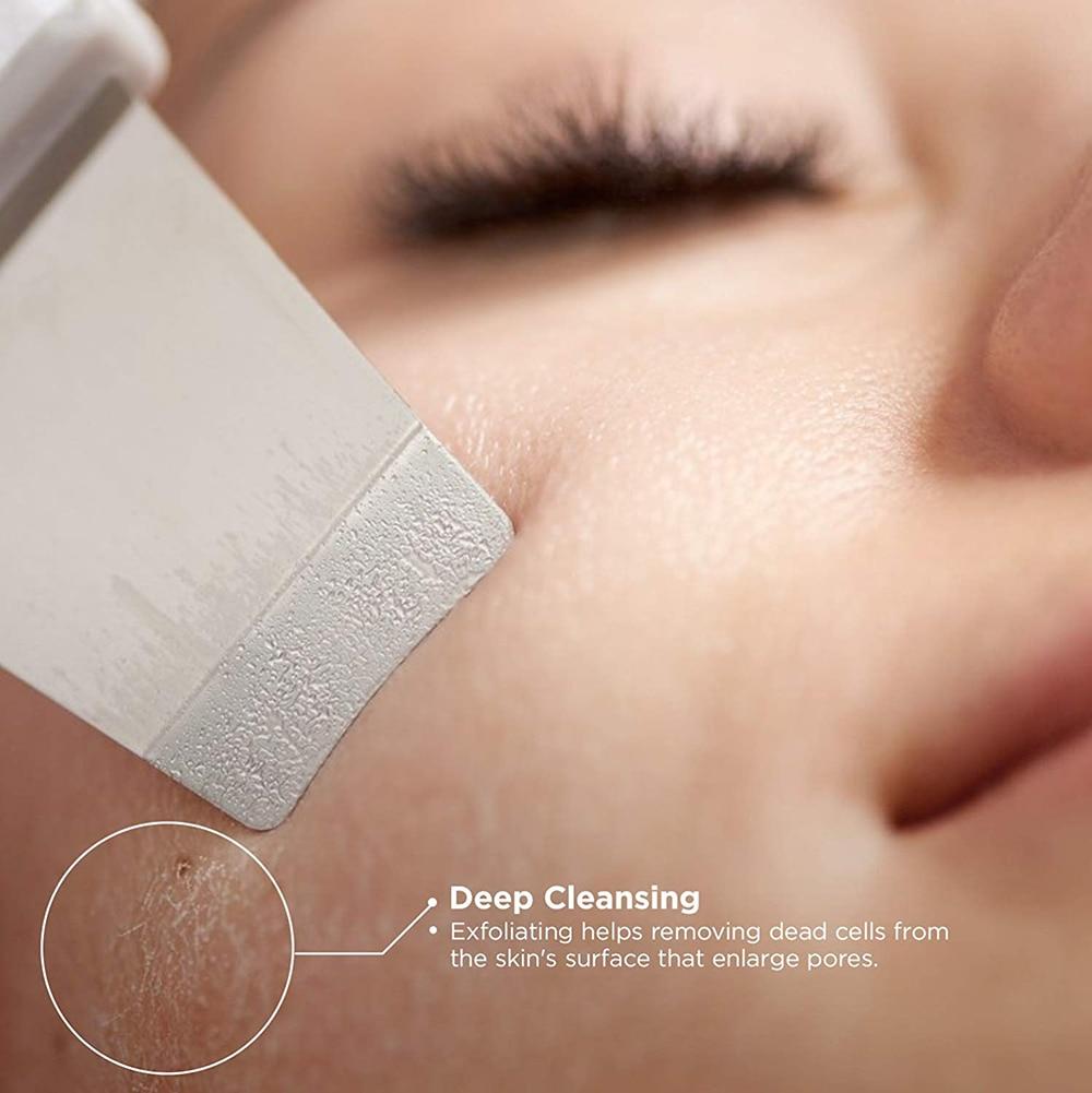 Ultrasonic Skin Exfoliator
